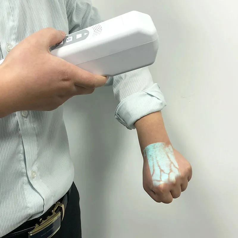 HSP-VT30 Medical Projection Portable Vein Finder