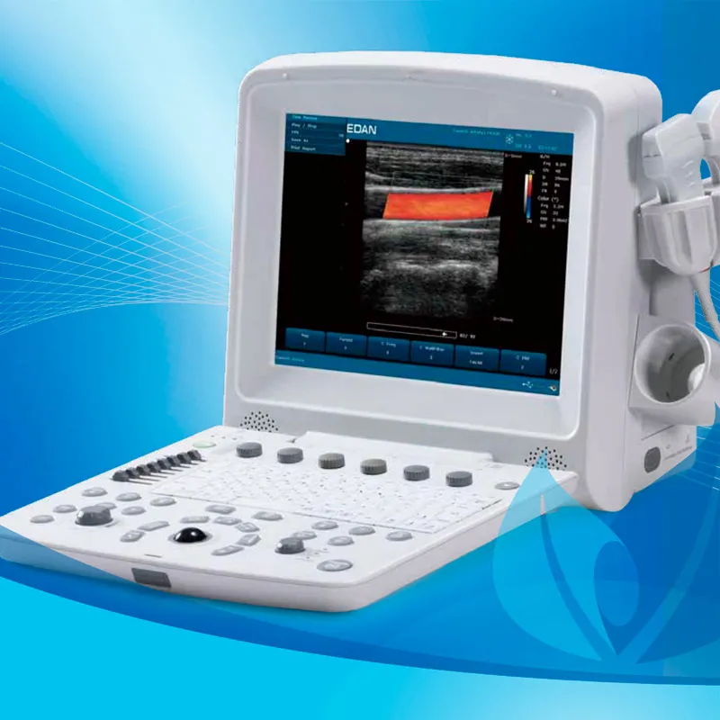U50 Diagnostic Ultrasound System