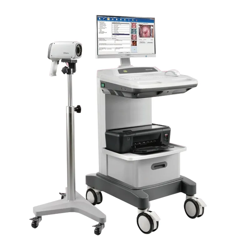 Edan C6 Portable  Diagnostic Video Colposcope