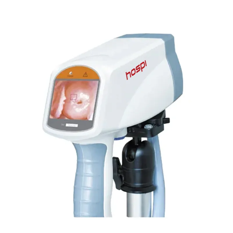 KN-2200 Digital Video Colposcope Equipment