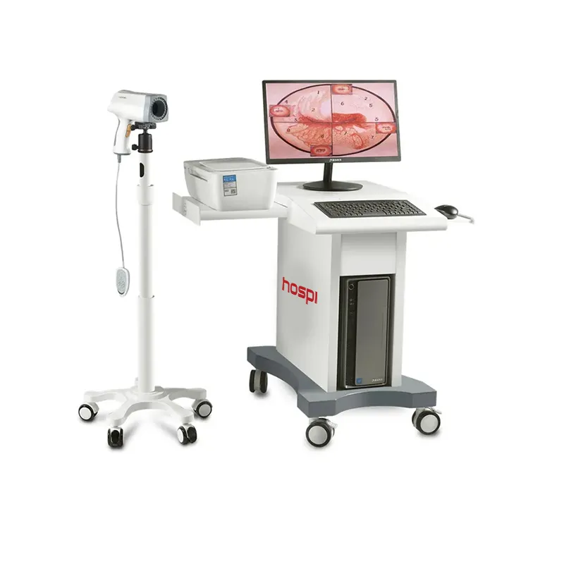 KN-2200 Digital Video Colposcope Equipment