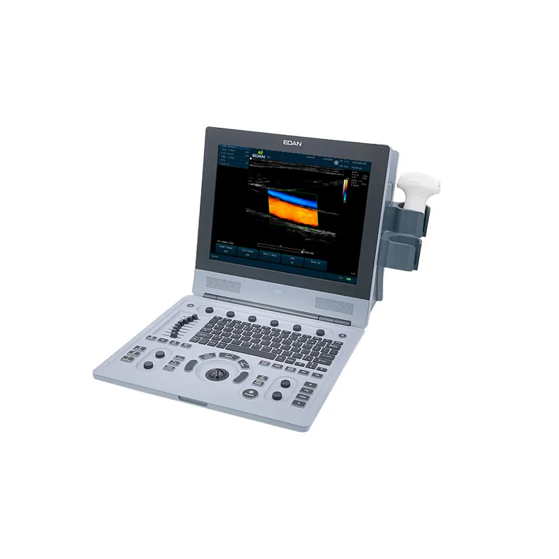 Edan U60 Medical Portable Ultrasound Scanner​