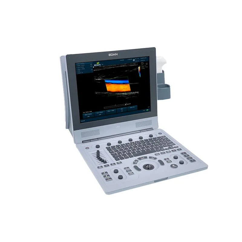 Portable Ultrasound Scanner​