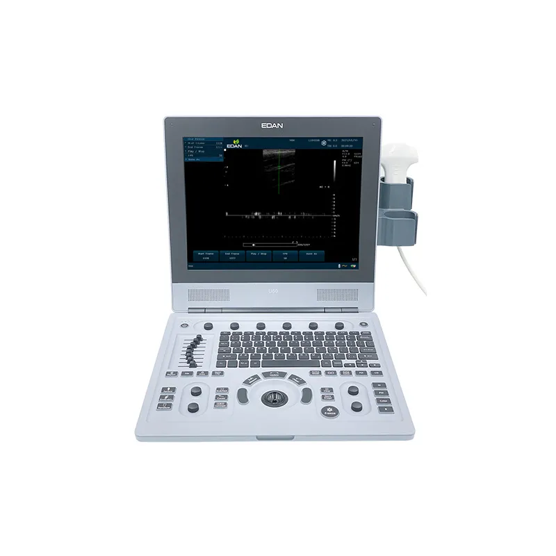 Portable Ultrasound Scanner​