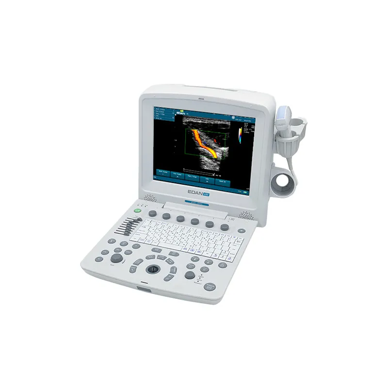 Diagnostic Ultrasound System