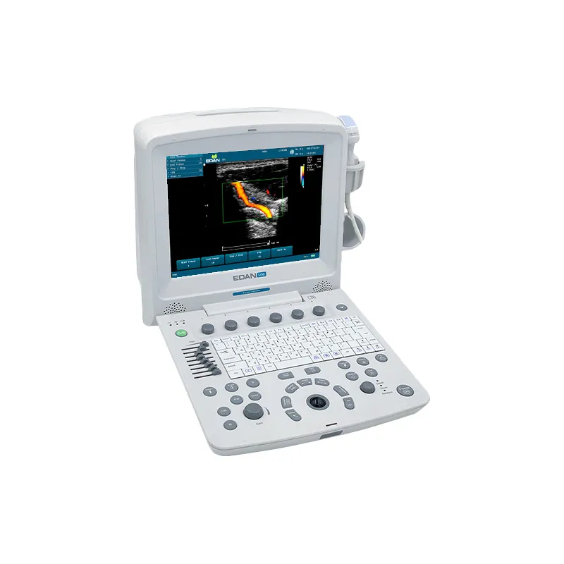 Diagnostic Ultrasound System