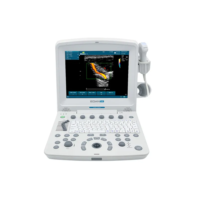 Diagnostic Ultrasound System