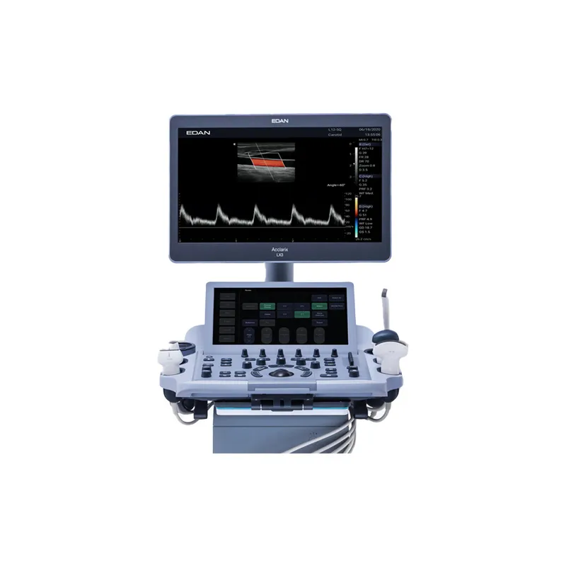 Acclaric LX3 Mobile Hospital Ultrasound Machine​