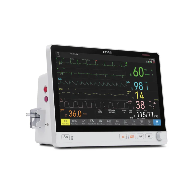 Edan UX10 Multi-Parameter 10.1'' Vital Signs Monitor For Patient