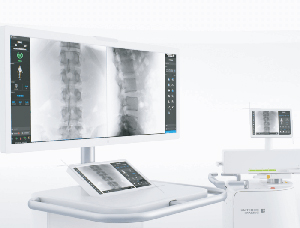uMC 560i Low Dose CMOS Mobile C-arm System